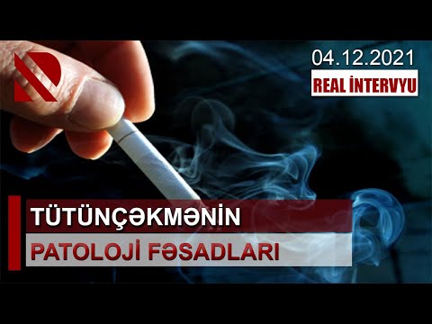 Video: Xroniki Xəstəliklərin şiddətlənməsinin Səbəbi Səbirdirmi?