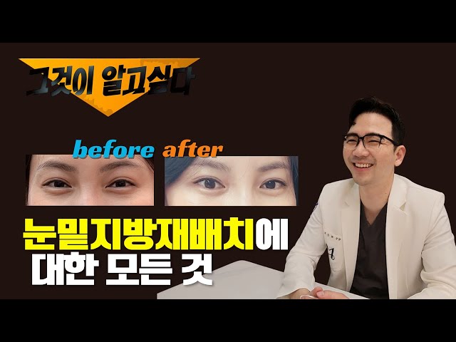 [그것이 알고싶다] 눈밑지방재배치에 대한 모든것 #성형외과 #눈밑지방재배치 #눈밑지 #지방이식 #동안성형  #뮤토엘 #그알 #그것이알고싶다