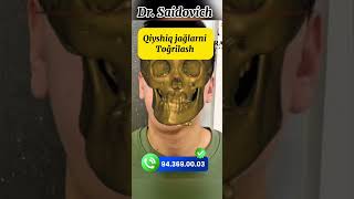 Yuz asimmetriyasini davolash OrtognatikaTashkent  #ortognatikatashkent #ortodont #stomatolog
