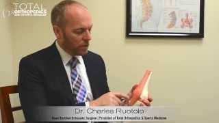 Osteoarthritis Treatments & Background by Dr. Charles Ruotolo