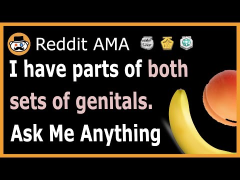 i-have-parts-of-both-sets-of-private-parts-(intersex).-(reddit-ask-me-anything)