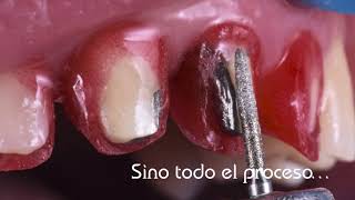 Curso De Bopt . Cristian Abad & Miguel Arroyo