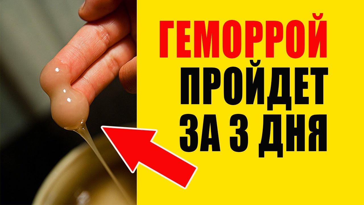 Лечение геморроя — чем и как вылечить геморрой | Daily Medical