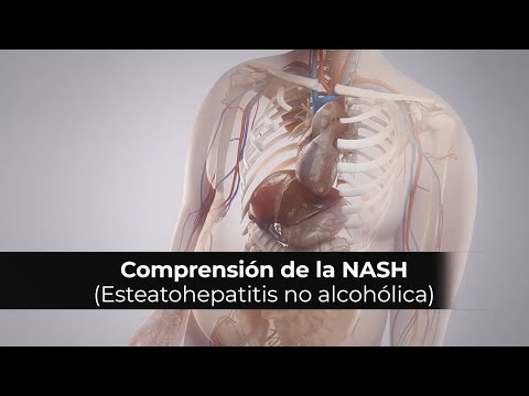 Video: ¿Qué significa esteatohepatitis no alcohólica?