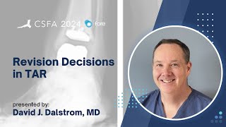 Revision Decisions In Tar  David J Dalstrom Md