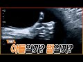 아들일까? 딸일까? Mp3 Song