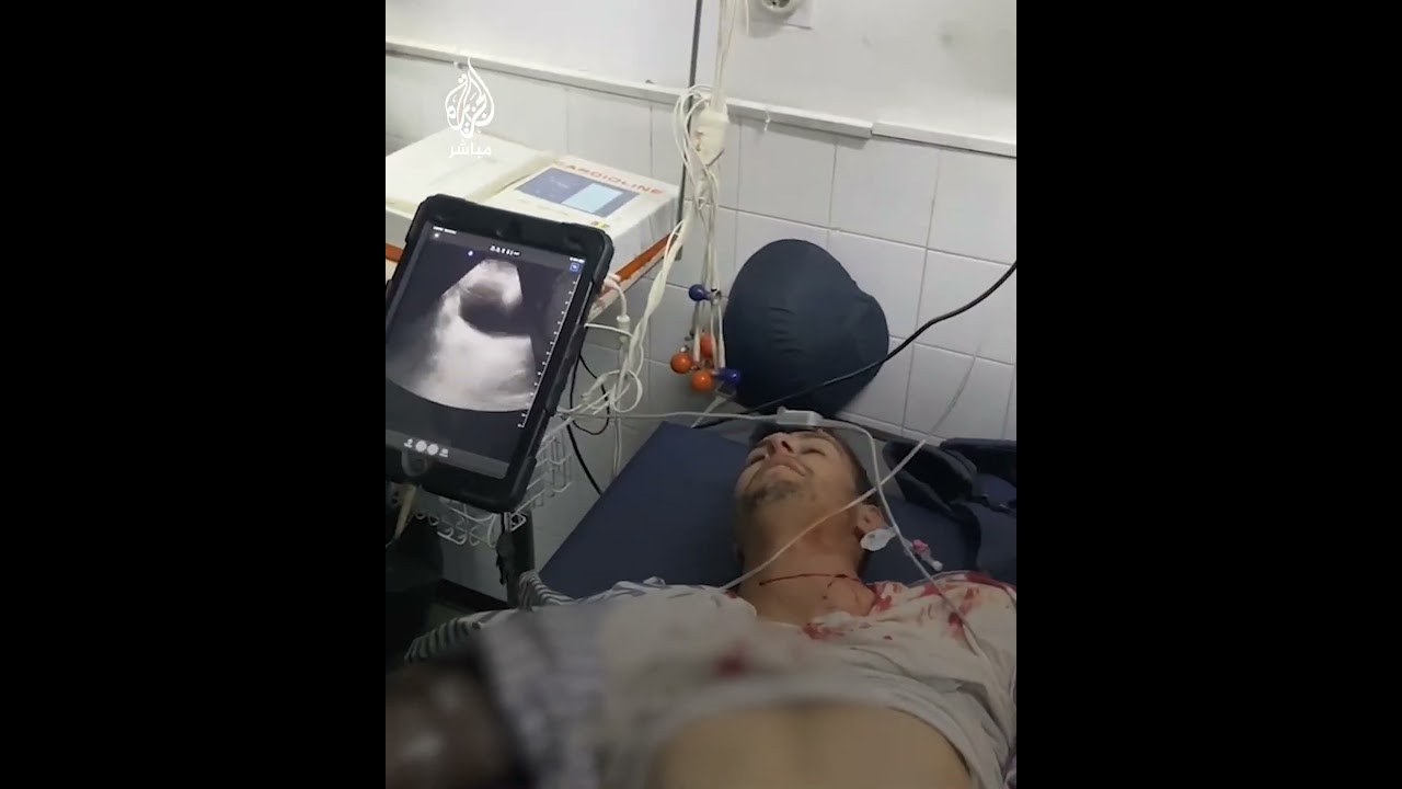 إصابة المصور في قناة الجزيرة فادي الوحيدي بعد إطلاق الاحتلال الرصاص عليه بمنطقة الصفطاوي شمالي غزة
