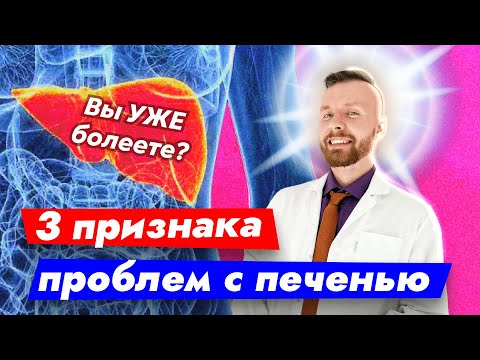 Симптомы болезни печени | Как понять, что у меня больная печень?