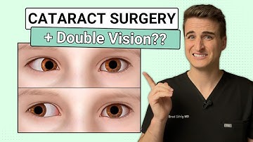 How Strabismus Affects Cataract Surgery - MD Explains What Patients Need to Know