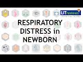 Respiratory Distress Syndrome in Newborn - Duke University