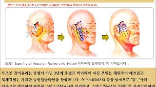 안면거상 수술 전후, 안면거상술 잘하는곳!