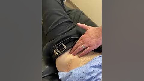 Manual Release of Lateral Femoral Cutaneous Nerve