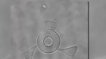 Nanobots to the Rescue! The Future of Medical Microbots