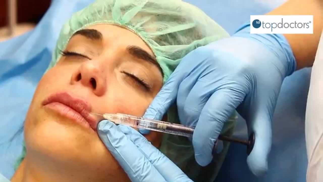 Aumento de labios con ácido hialurónico