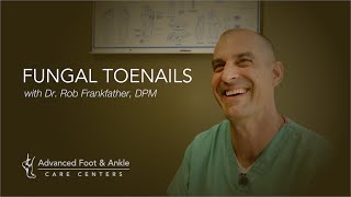 Fungal Toenails - What They Are &amp; How To Treat Them