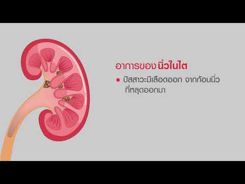 40ปีมูลนิธิโรคไต EP20