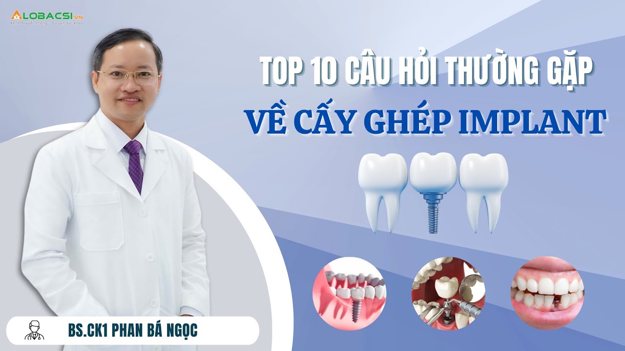 Outline Video 10 câu hỏi thường gặp về cấy ghép implant | BS.CK1 Phan Bá Ngọc