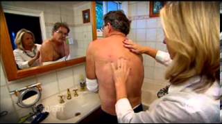 Cancer Council Australias Launch Of National Skin Cancer Action Week 2012