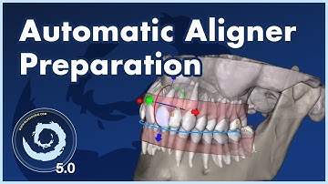 BSPV5.0: Save Time with Automatic Aligner Data Preperation!