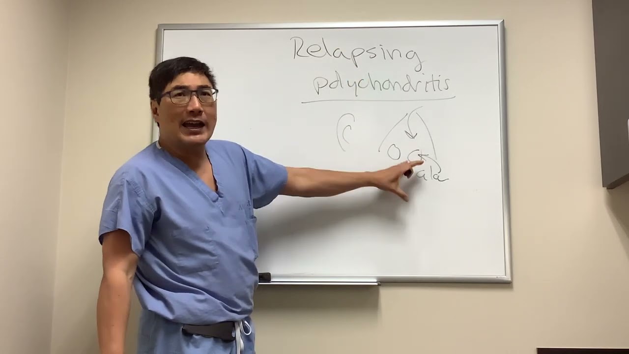 Relapsing polychondritis