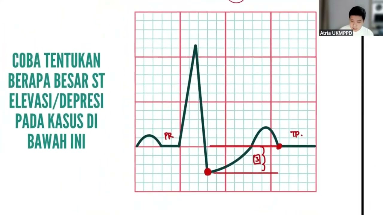 Class Clips - ST Depresi & Elevasi