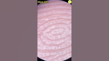 Hand Under Microscope | TULO - Microscope #shorts #microscope #hand #underthemicroscope #bacteria