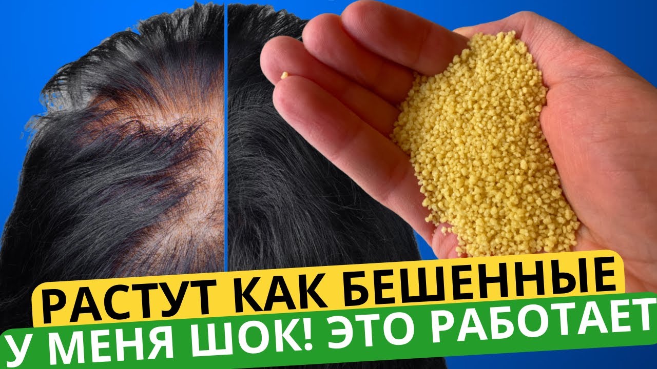 1 ложка и Волосы Начинают Расти даже на Лысинах! Растут длинными, не ...