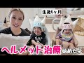 【生後4ヶ月】ヘルメット治療について詳しく話します