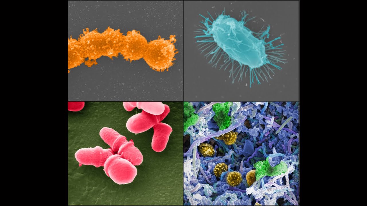 Going Beyond The Gut: The Future Of Microbiome Therapeutics