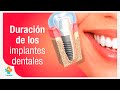 Duración de los implantes dentales | Tu Salud Guía