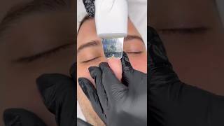 Men’s Nose Extractions