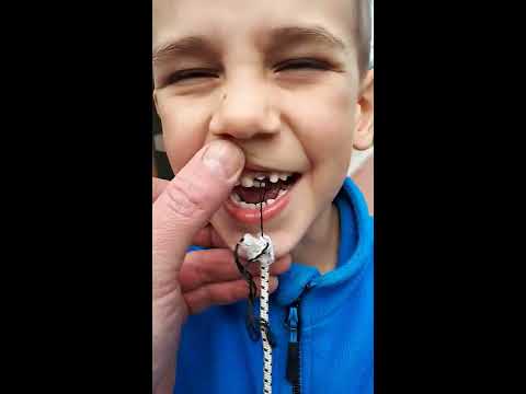 Video: Keď dieťaťu začnú vypadávať mliečne zuby