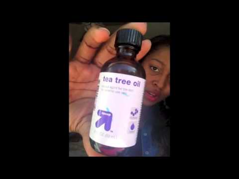 Get rid of your ugly keloids!!! (tea tree oil method Before and after results)