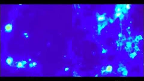 Wireless brain stimulation