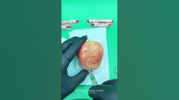 Funny   Phẫu thuật thay đổi nụ cười cho