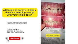 Attention parents: 7 signs there could be something wrong with your child's teeth