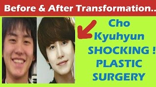 Cho Kyuhyun Plastic Surgery Before And After Full Hd