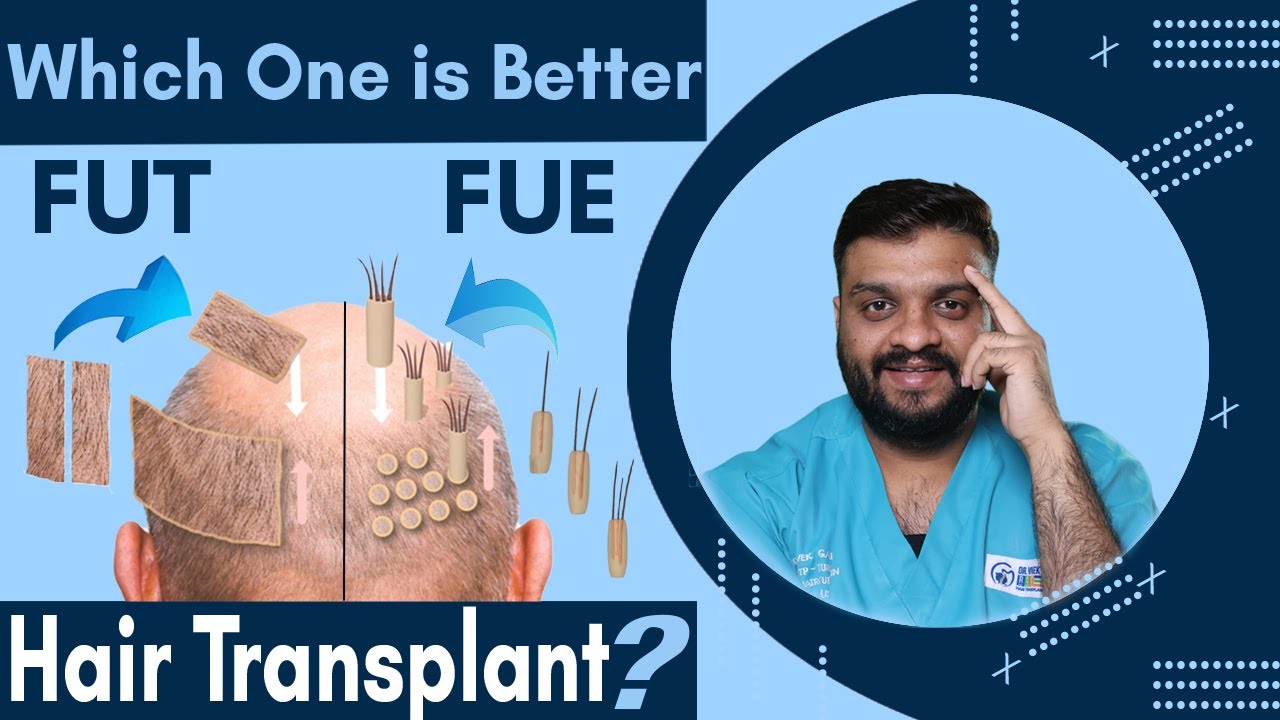 FUE vs FUT Hair Transplant | Which is BEST for you? | Dr. Vivek Galani | RQC