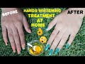 Skin whitening  hand skin whitening remedy  hands whitening treatment at home  tulikajagga