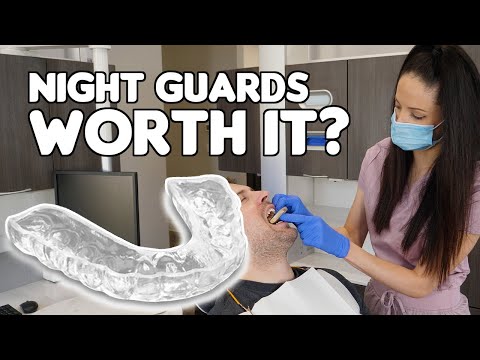 Are Night Guards REALLY Worth It?