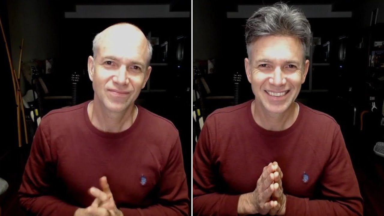 Do You Prefer To Wear A Hair System Or A Hat If You re Going Through 