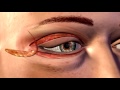 Cosmetic Eye and Eyelid Surgery - 3D Medical Animation || ABP ©