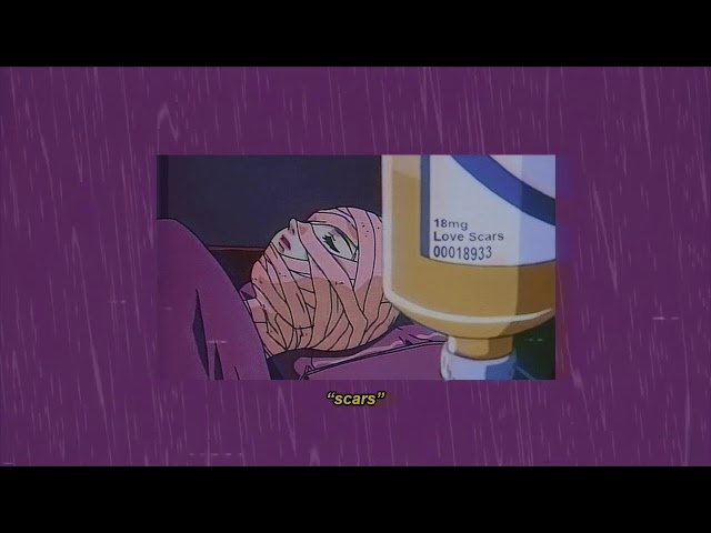 ondi vil - scars (ft. mishaal)