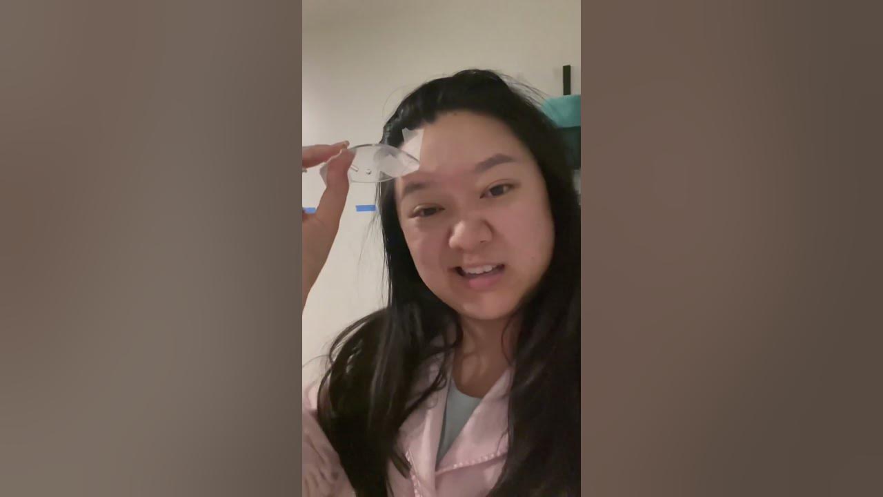 Laser Eye Surgery Morning Routine Removing Sleep Goggles After ICL