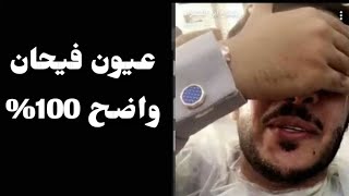 عيون فيحان بدون نظارة