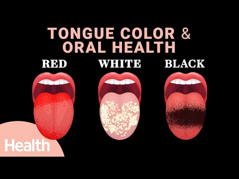 आपकी जीभ आपको आपके स्वास्थ्य के बारे में क्या बताती है | जीभ का रंग, स्वाद कलिकाएँ, COVID जीभ, और मुख स्वास्थ्य