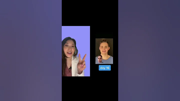 Palatal Expander for a narrow arch  #palatalexpander