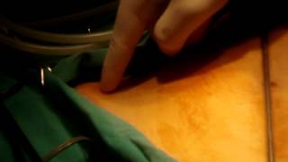 Laparoskopide Batına Giriş Bölgeleri