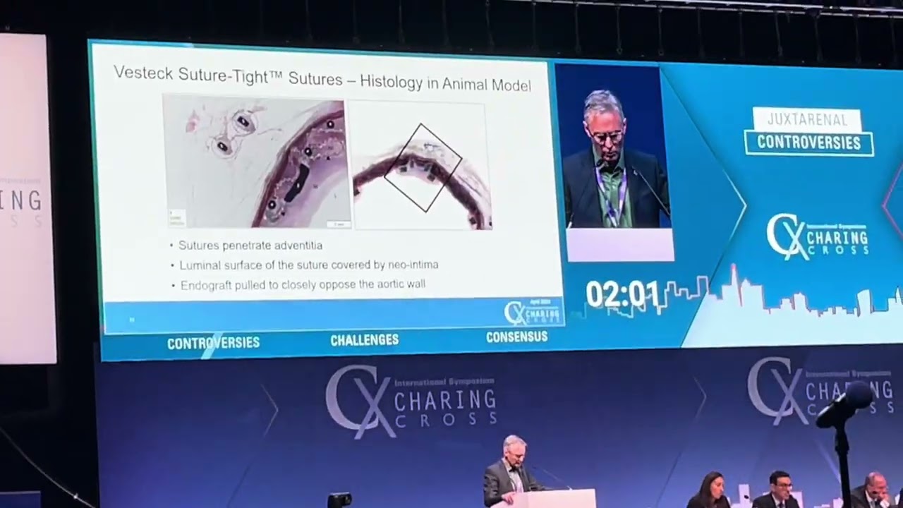 Professor Andrew Holden Presents VESTECK at Charing Cross 2024.