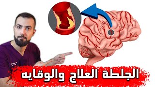 الجلطه او السكته. كيف تحمي نفسك منها في عصرنا الحالي